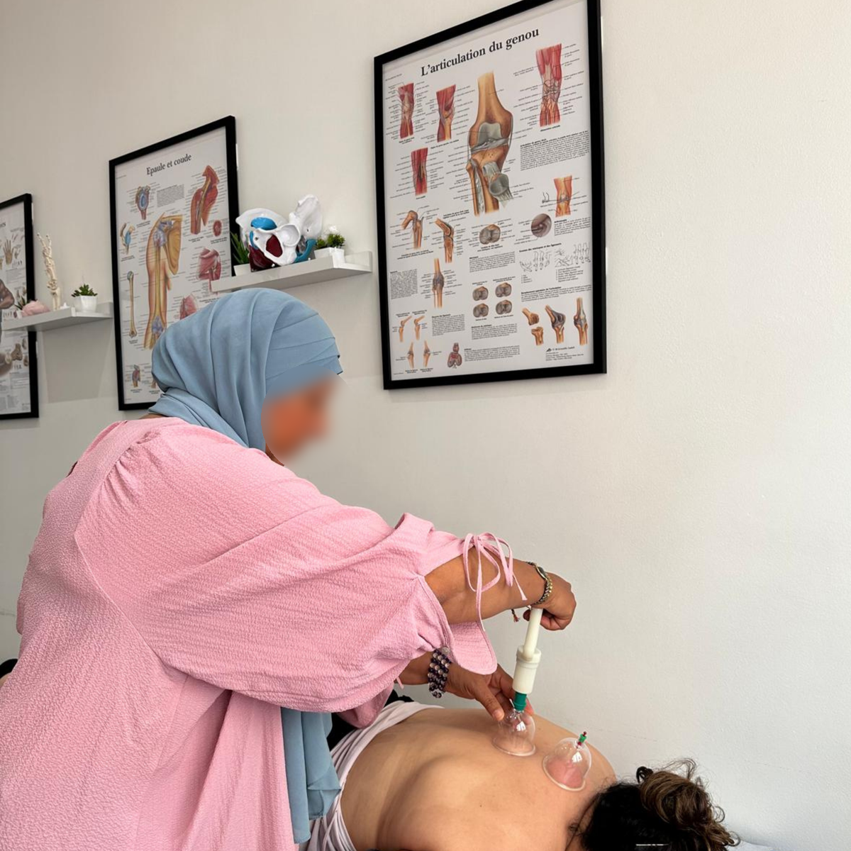 Cupping / Hijama